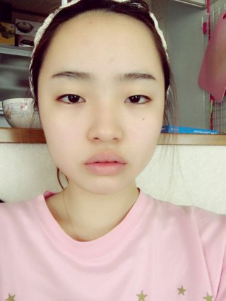 ビフォー