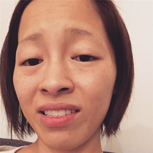 小森純 逆奇跡の一枚